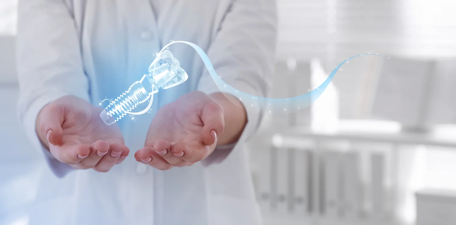 Implanty zębowe Warszawa gdzie najlepiej?